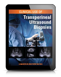 Clinical Use Of Transperineal Ultrasound Biopsies | BK Ultrasound