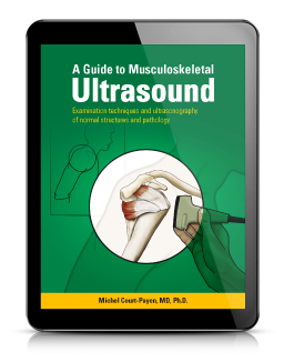 A Guide To Musculoskeletal Ultrasound | BK Ultrasound